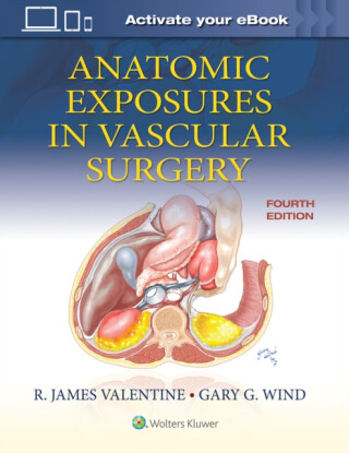 Anatomic Exposures in Vascular Surgery - Gary G., MD Wind,R. James, MD, FACS Valentine