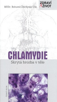 Chlamydie - Bohumil Ždichynec
