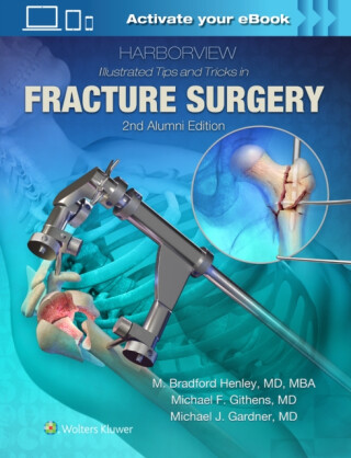 Harborview Illustrated Tips and Tricks in Fracture Surgery - M. Bradford Henley,Michael F. Githens,Michael J. Gardner