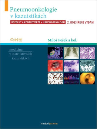 Pneumoonkologie v kazuistikách - Úspěchy a kontroverze v hrudní chirurgii - Miloš Pešek,kolektiv autorů