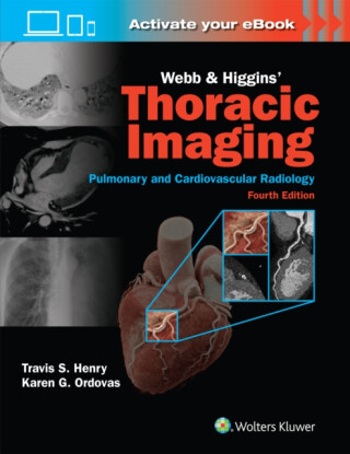 Webb & Higgins Thoracic Imaging: Print + eBook with Multimedia - KAREN GOMES, MD, MAS ORDOVAS,Travis Scott, MD Henry